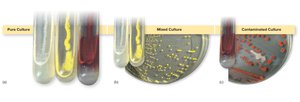 Pure, Mixed, and Contaminated Cultures