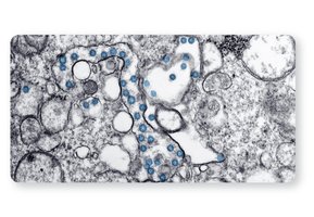 Transmission Electron Microscopy