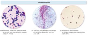 Differential Stains