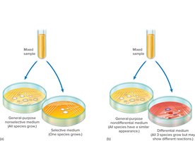 Comparison of Selective and Differential Media