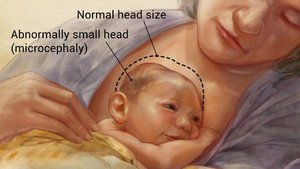 Zika virus tissue tropism