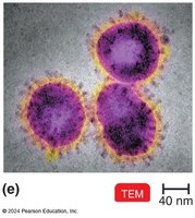 Viruses under TEM