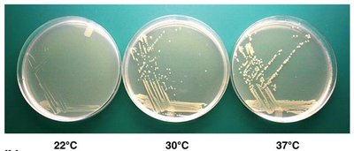 Growth of E. coli on nutrient agar at different temperatures