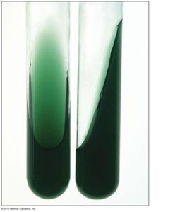 Petri plate with bacterial colonies
