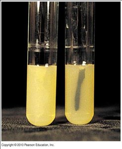 Agar slants and deeps