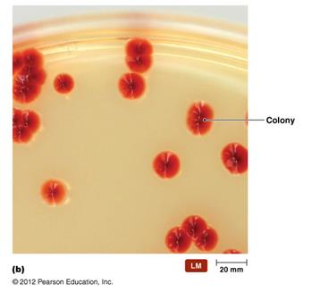 Table of colony morphology characteristics