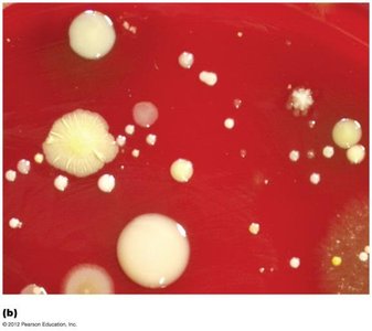 Pure and mixed cultures on agar plate