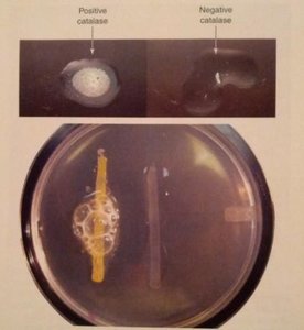 Catalase test: positive and negative reactions