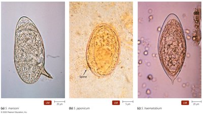 Eggs of Schistosoma species