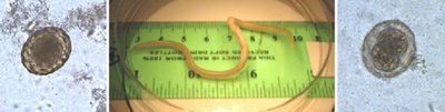 Nematode