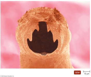 Mouth of a hookworm