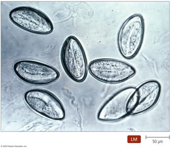 Eggs of Enterobius vermicularis