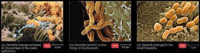 Normal microbiota on epithelial surfaces