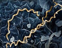 Treponema pallidum (syphilis)