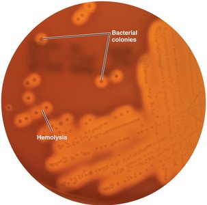 Blood agar as a differential medium
