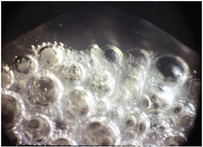 Catalase test