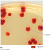 Bacterial colony morphology
