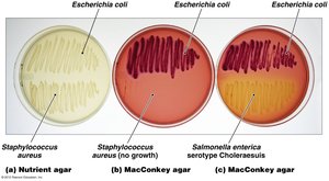 MacConkey agar as selective and differential medium