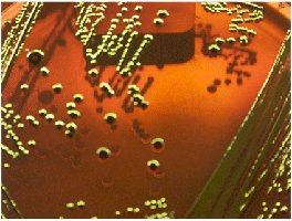 E. coli on EMB agar