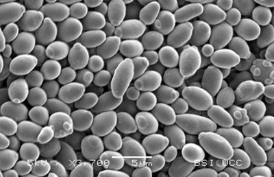 SEM image of yeast cells