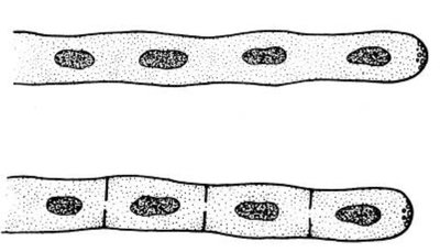 Diagram of aseptate and septate hyphae
