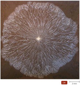 Light microscopy image of fungal mycelium