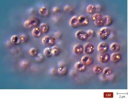 Deposits of sulfur within purple sulfur bacteria