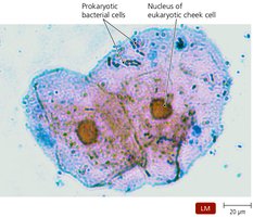 Bacterial cells and human cheek cells under a microscope