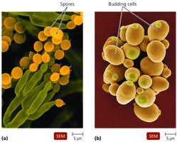 Fungi: Spores and budding yeast cells under a scanning electron microscope