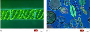 Algae: filamentous and diatom forms under a microscope