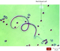 Immature stage of a parasitic worm in blood
