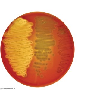 Blood agar showing hemolysis types