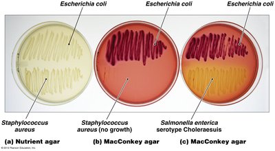 MacConkey agar with different bacteria