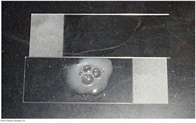 Catalase test showing bubble formation