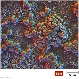 SEM image of biofilm structure