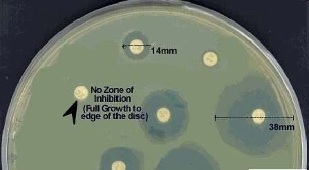 Kirby-Bauer disk diffusion test showing zones of inhibition