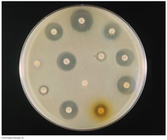 Diameter of zone of inhibition measured in disk diffusion test