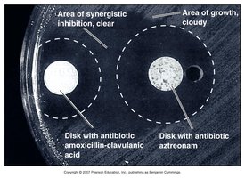 Zone of inhibition showing synergistic and antagonistic effects