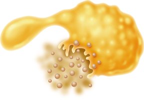 Injury to the plasma membrane of a yeast cell caused by an antifungal drug