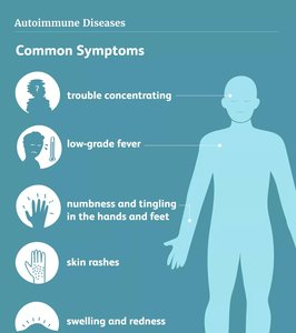 Common symptoms of autoimmune diseases