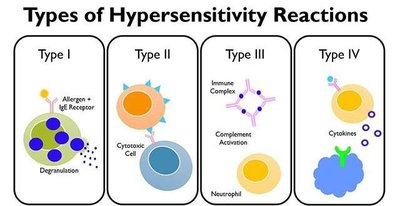 Types of hypersensitivity reactions summary
