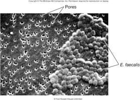 SEM of filter pores and bacteria