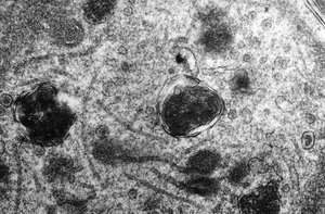 Electron microscopy of prion diseases