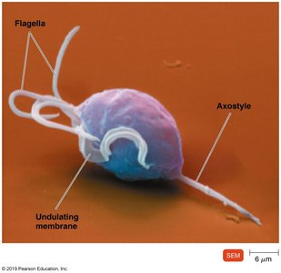 Trichomonas vaginalis under electron microscope