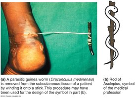 Parasitology: Guinea worm removal