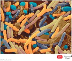 Normal intestinal bacteria