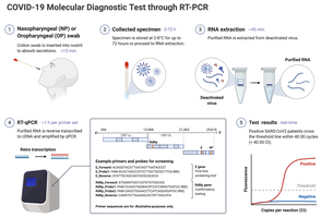 COVID-19 RT-PCR diagnostic workflow