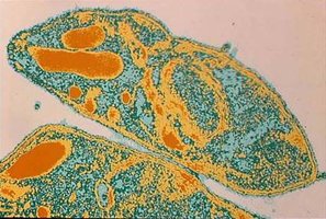 Plasmodium falciparum image