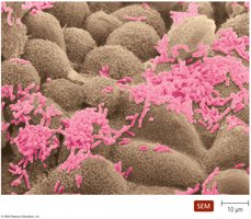 Normal microbiota on human tissue