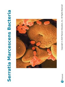 Serratia marcescens bacteria